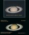 Saturno Tratamiento